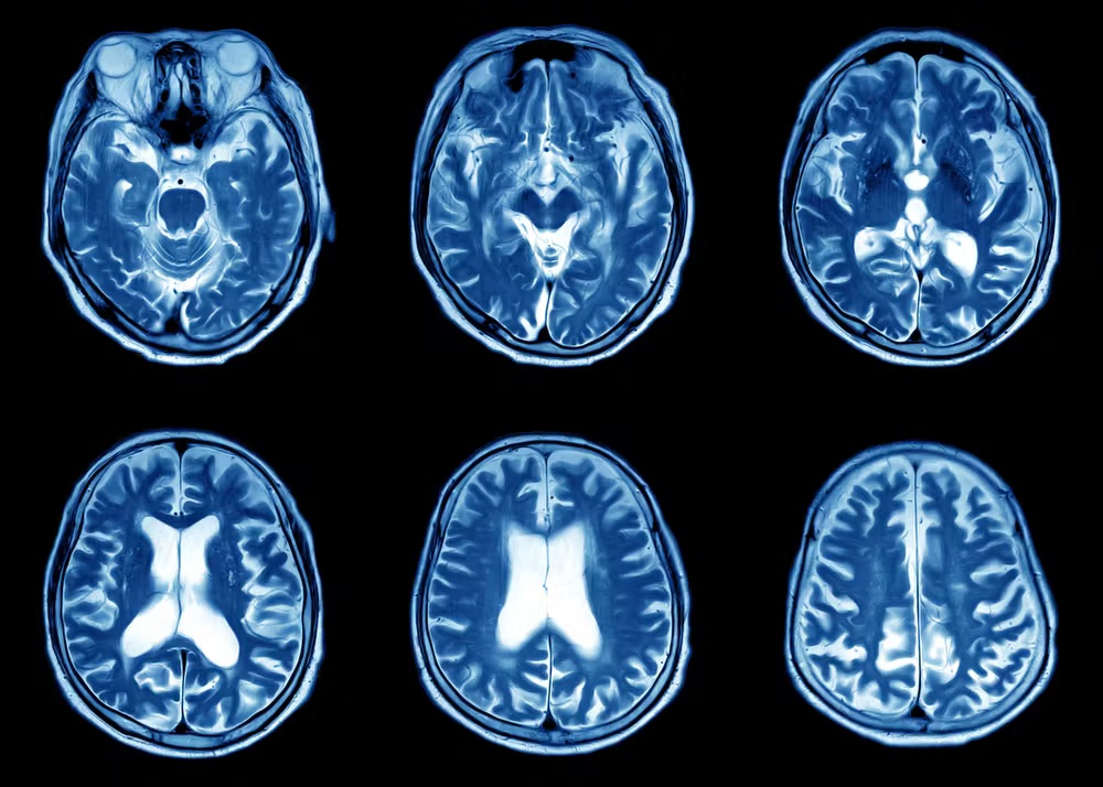 Sự khác nhau giữa chụp siêu âm, MRI và CT – Hiểu để chọn đúng