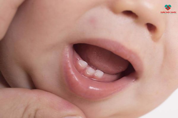 thời kỳ bé mọc răng nanh khiến bé mọc răng biếng ăn