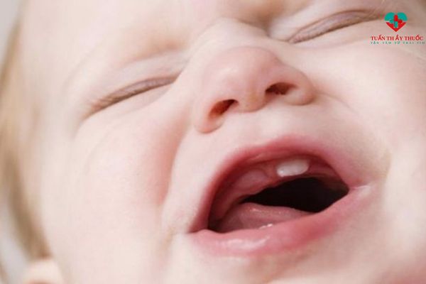 Bé không chịu bú bình khi thức do bé mọc răng