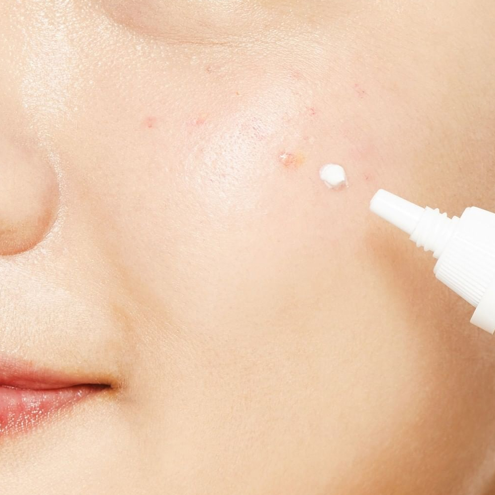 cách dùng Kem Dưỡng Chấm Mụn COSRX AC COLLECTION ULTIMATE SPOT CREAM