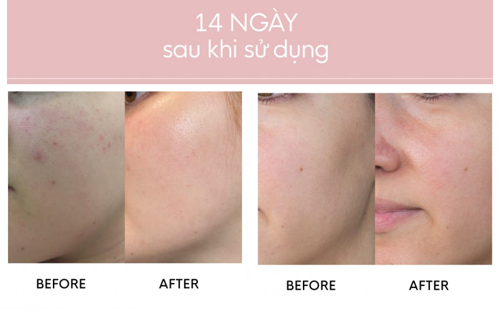 tinh Chất Gilaa Saffron Tone Up Repair Serum