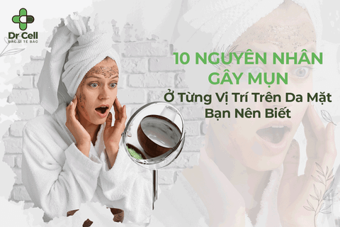 10 Nguyên Nhân Gây Mụn Ở Từng Vị Trí Trên Da Mặt Bạn Nên Biết