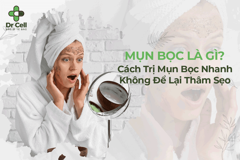 Mụn Bọc Là Gì? Cách Trị Mụn Bọc Nhanh Không Để Lại Thâm Sẹo