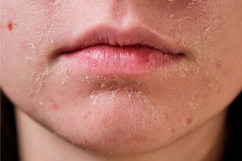 Cấp ẩm mỗi ngày rồi, sao da vẫn khô và thiếu sức sống?
