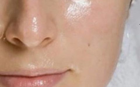 Tại sao da cứ “bóng dầu” cả ngày dù bạn đã rửa mặt kỹ?