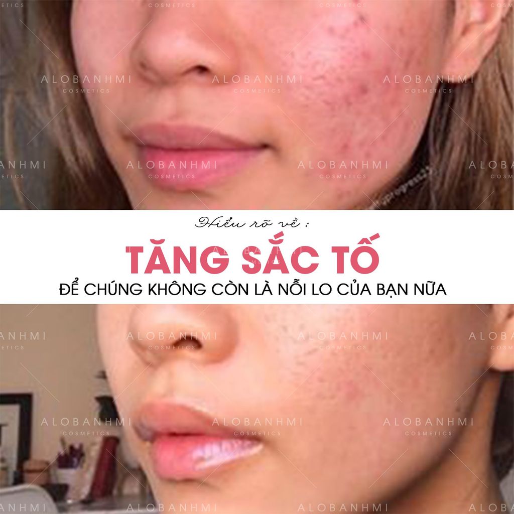 HIỂU RÕ VỀ TĂNG SẮC TỐ ĐỂ CHÚNG CHẲNG CÒN LÀ NỖI LO CỦA BẠN NỮA