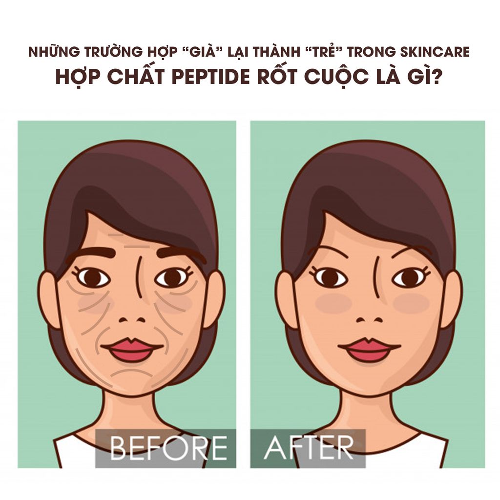 NHỮNG TRƯỜNG HỢP “GIÀ” LẠI THÀNH “TRẺ” TRONG SKINCARE – HỢP CHẤT PEPTIDE RỐT CUỘC LÀ GÌ?