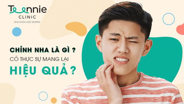 Chỉnh nha là gì? Có thực sự mang lại hiệu quả không?