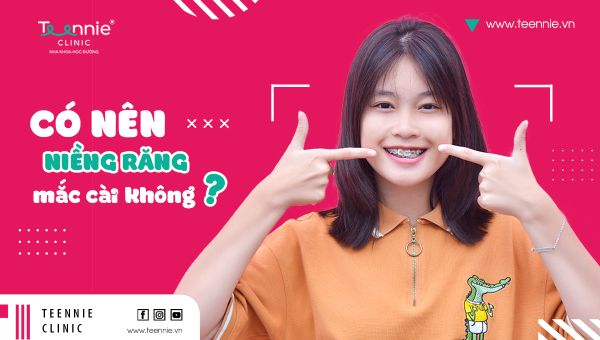Niềng răng mắc cài nên hay không nên và những lưu ý?
