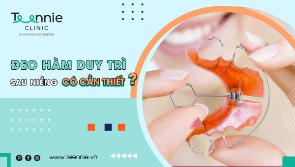 Đeo hàm duy trì sau khi niềng răng có thực sự cần thiết?