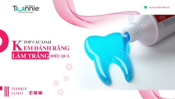 Top các loại kem đánh răng làm trắng hiệu quả