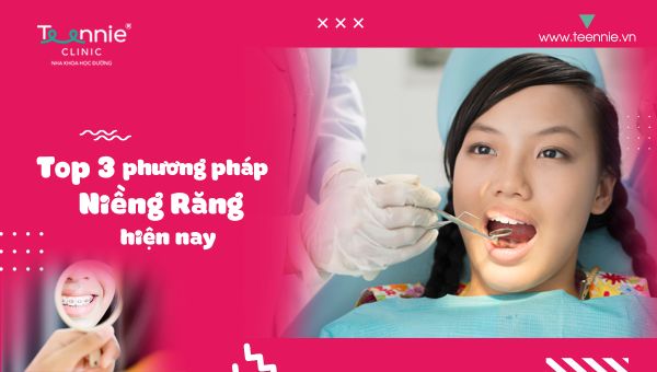 Niềng răng là gì? TOP 3 phương pháp niềng răng phổ biến hiện nay