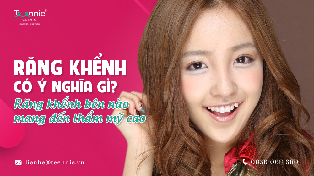 Giải đáp thắc mắc Răng khểnh có ý nghĩa gì?