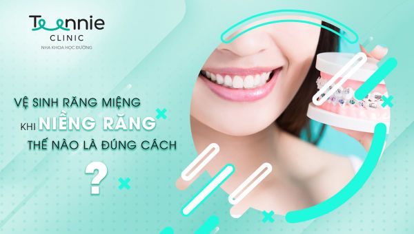 Vệ sinh răng miệng khi niềng răng như thế nào là đúng cách?