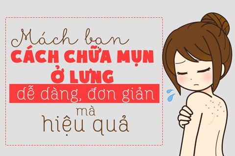 MỤN TRỨNG CÁ