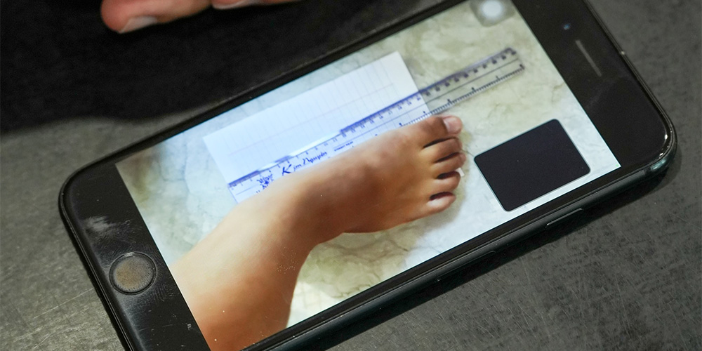 Tại sao bạn cần xác định form chân trước khi mua giày đá bóng