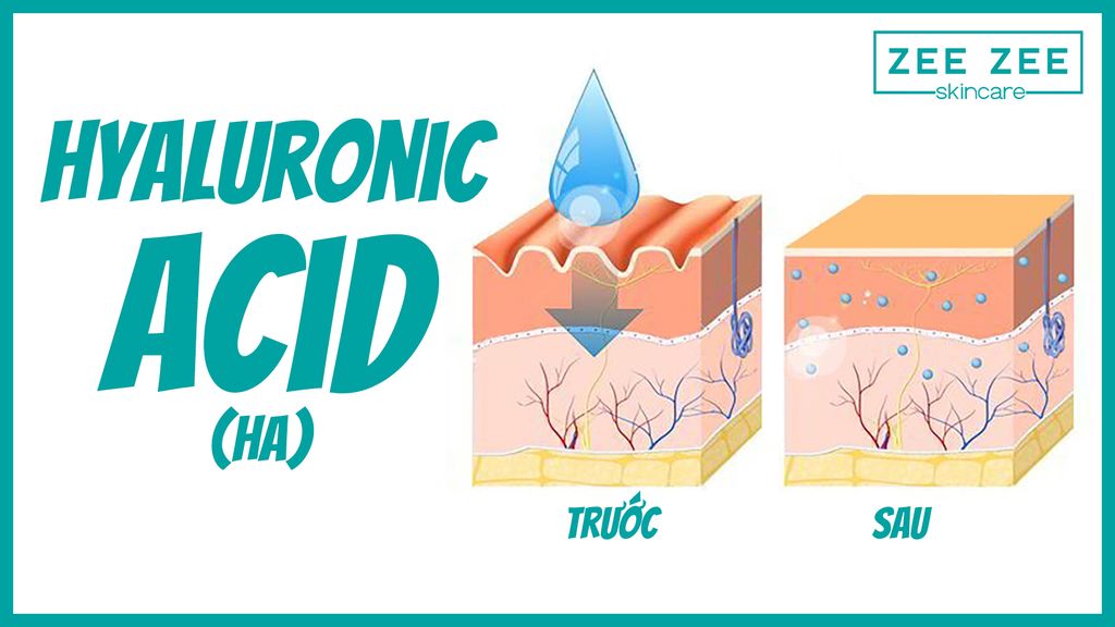 Lý do nên chọn mỹ phẩm có chứa Hyaluronic Acid (HA)