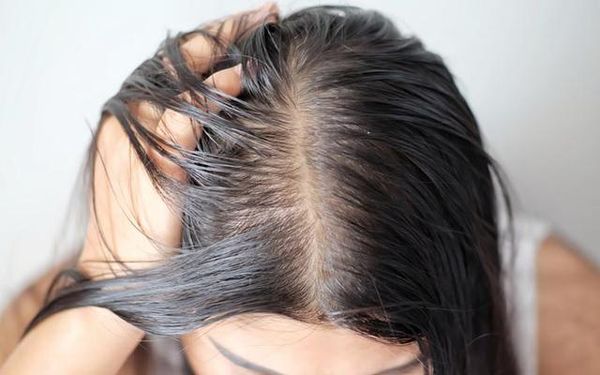 3 cách giải quyết tóc bết vì dầu
