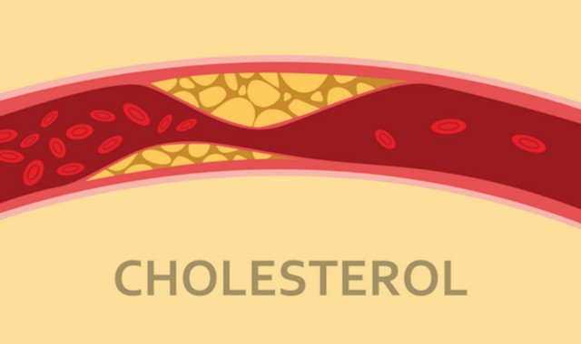 Cholesterol Có Tác Dụng Gì Và Chúng Có Lợi Hay Có Hại?_1