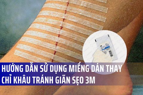 Miếng dán vết thương thay chỉ khâu 3M Steri Strip: Hướng dẫn sử dụng