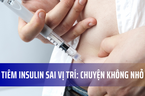 Tiêm insulin sai vị trí: Chuyện không nhỏ
