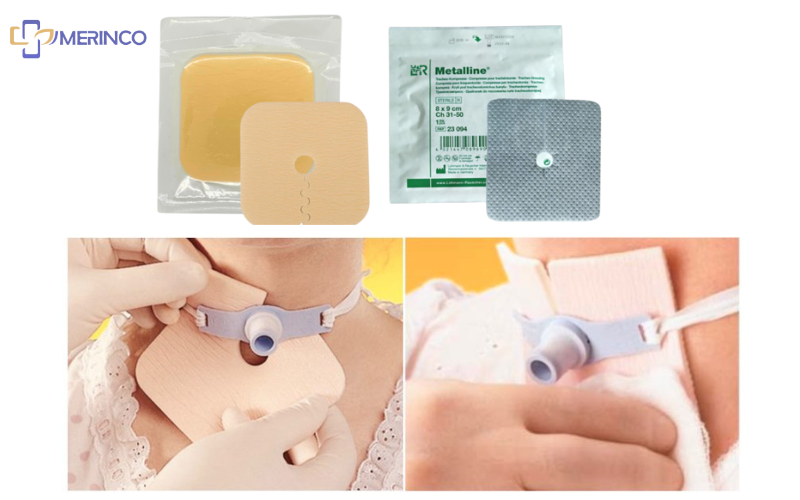 Gạc chân ống mở khí quản