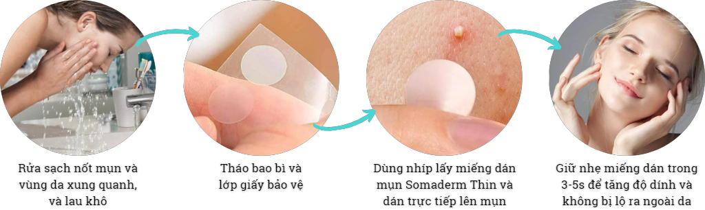Miếng dán mụn Somaderm-Thin giảm hình thành sẹo loại mỏng (24 miếng)
