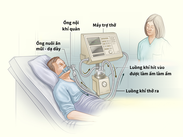 Máy trợ thở là gì? Khi nào cần sử dụng máy trợ thở