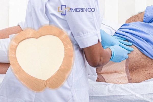 Tìm hiểu các loại loét da