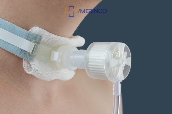 Hướng dẫn chăm sóc bệnh nhân mở khí quản