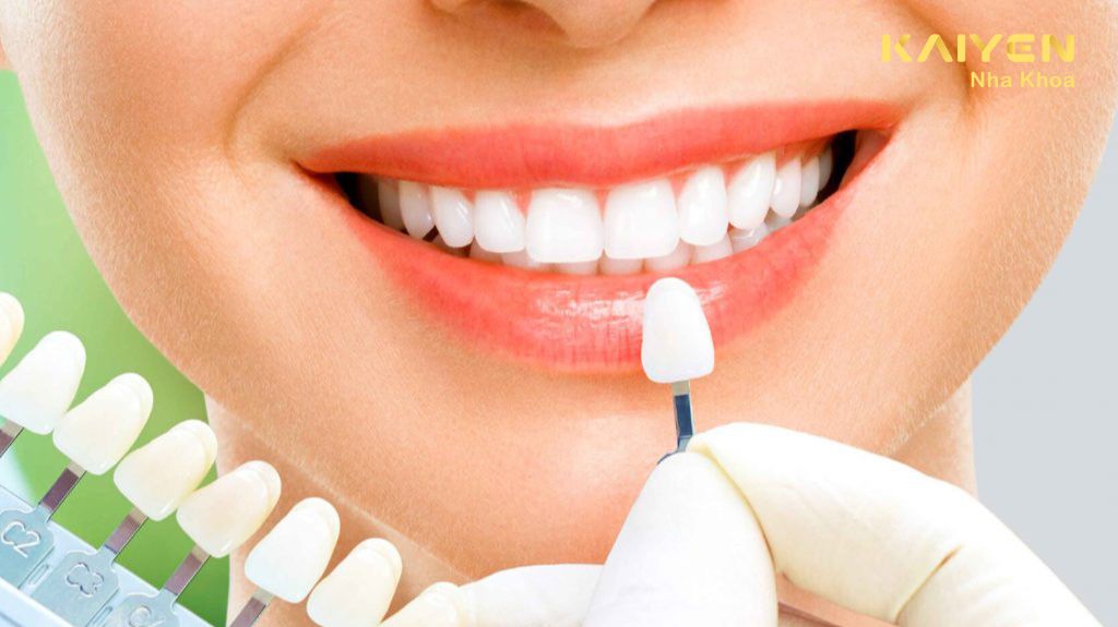 Cách Chăm Sóc Và Vệ Sinh Răng Sứ Bền Lâu