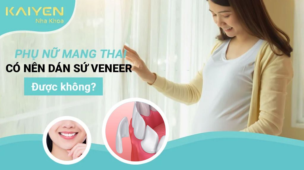 Đang mang thai có nên thực hiện dán sứ Veneer không?