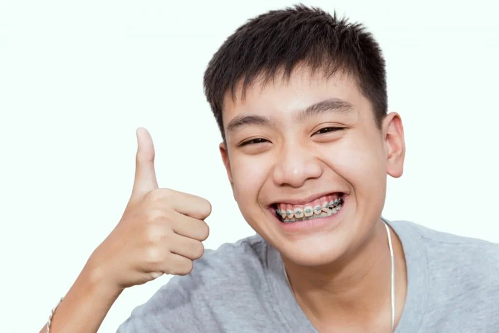Độ Tuổi Lý Tưởng Nhất Để Có Thể Niềng Răng