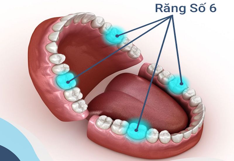 Răng Số 6 Là Răng Nào? Làm Gì Khi Răng Số 6 Bị Sâu, Tổn Thương