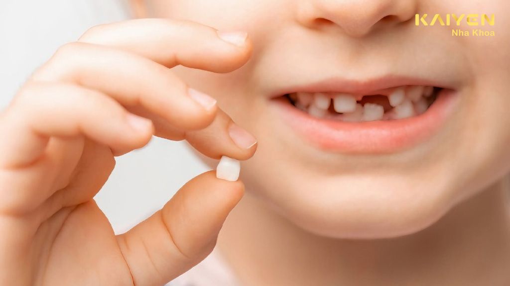 Vai Trò Của Răng Sữa Và Hậu Quả Khi Mất Răng Sữa Sớm