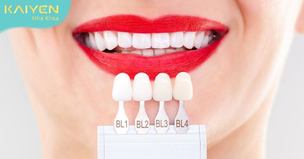 Răng sứ vừa mang lại vẻ đẹp thẩm mĩ, vừa cải thiện chức năng ăn nhai