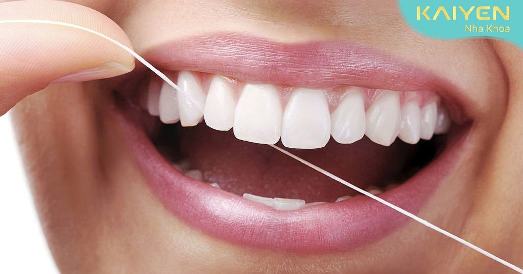 Chỉ nha khoa giúp ngăn ngừa nhiều bệnh lý răng miệng cho răng chắc khỏe