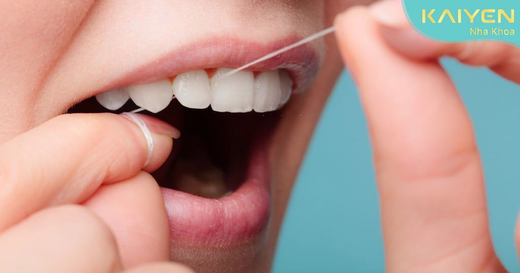 Chỉ nha khoa giúp nướu khỏe mạnh, răng lâu rụng hơn