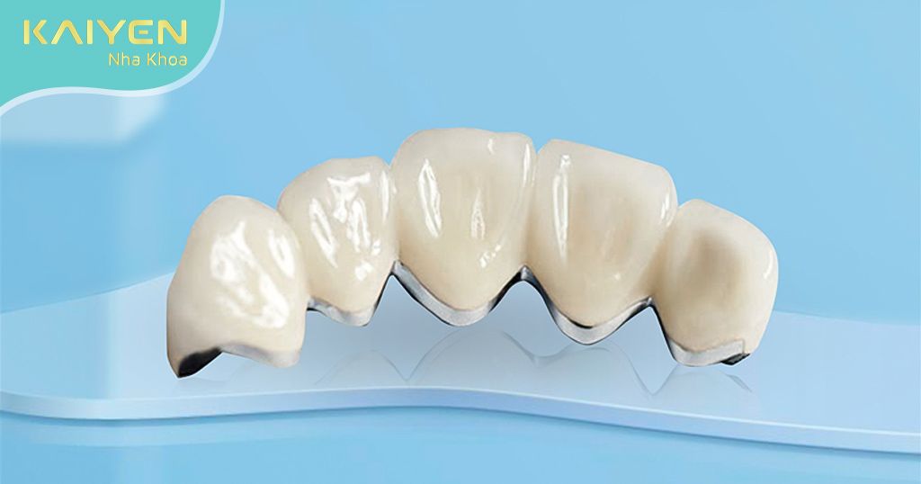 Giá bọc răng sứ Ceramco tương đối hợp lý, phù hợp với nhiều đối tượng khách hàng