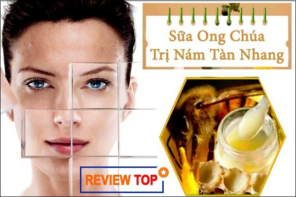 SỮA ONG CHÚA TRỊ TÀN NHANG GIÚP LÀN DA TƯƠI ĐẸP