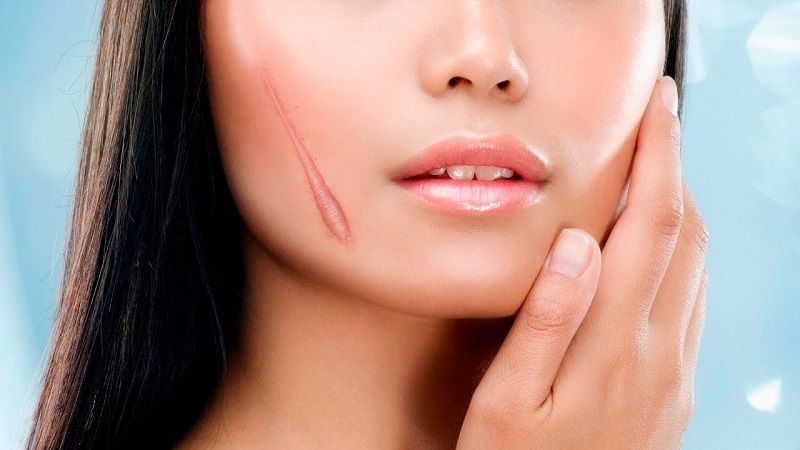 MẬT ONG VỚI CÁC VẾT SẸO DA