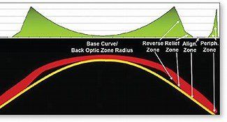 Kính áp tròng cứng và mềm có giống nhau không?