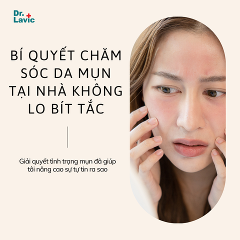 BÍ QUYẾT CHĂM SÓC DA MỤN TẠI NHÀ KHÔNG LO BÍT TẮC