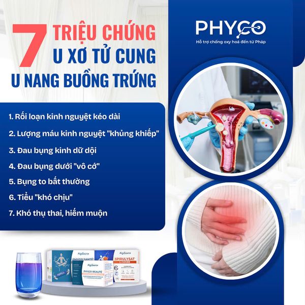 CẢNH BÁO 🚨 7 TRIỆU CHỨNG "BÁO ĐỘNG" U XƠ TỬ CUNG, U NANG BUỒNG TRỨNG: TUYỆT ĐỐI KHÔNG ĐƯỢC CHỦ QUAN!