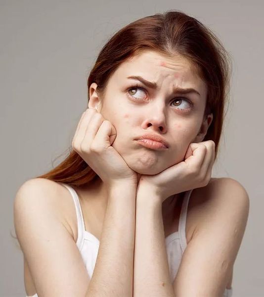 TOP 5 "LỜI ĐỒN" TRUYỀN TAI CẦN LOẠI BỎ KHI CHĂM SÓC DA MỤN