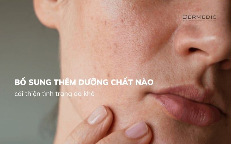 Da khô thiếu chất gì? Bổ sung thêm dưỡng chất nào sẽ cải thiện?
