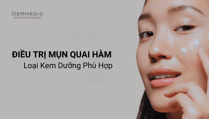 Điều trị mụn ở quai hàm và loại kem dưỡng phù hợp cho bạn