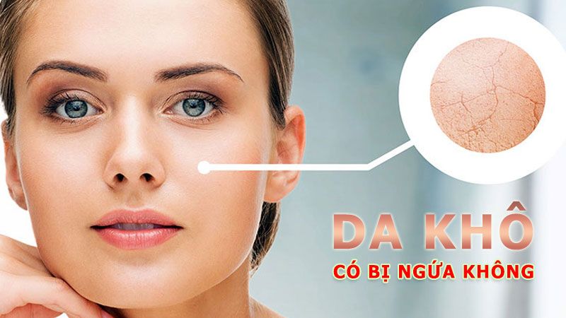 Da khô có bị ngứa không: Giải đáp và tư vấn khắc phục