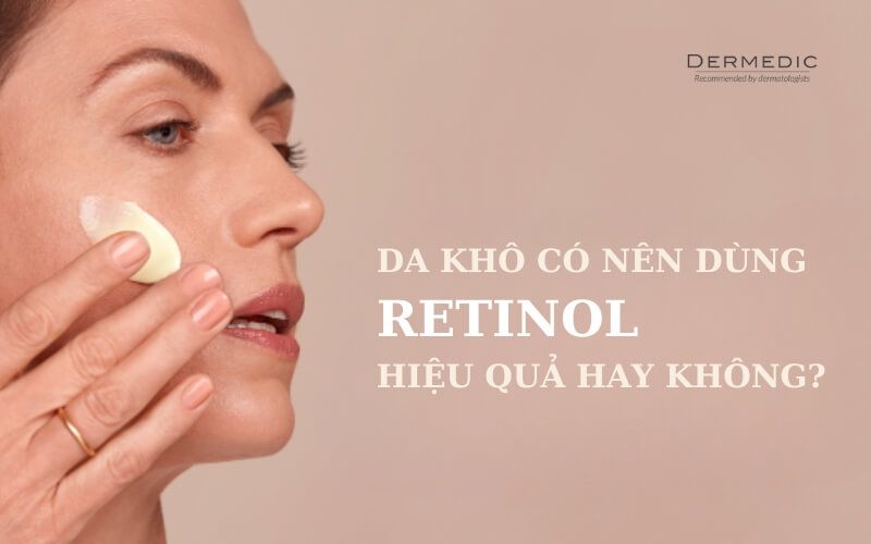 Da khô có nên dùng Retinol không? Lưu ý khi dùng Retinol cần ghi nhớ