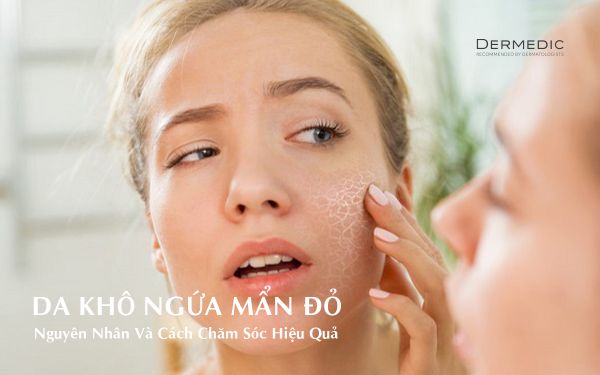 Da Khô Ngứa Mẩn Đỏ Mùa Đông: Nguyên Nhân Và Cách Chăm Sóc Hiệu Quả